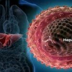 Gejala Hepatitis Akut dan Penyebabnya Jasa Pest Control di Semarang